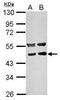 Protein Phosphatase Methylesterase 1 antibody, PA5-27754, Invitrogen Antibodies, Western Blot image 
