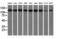Histone Deacetylase 6 antibody, GTX84377, GeneTex, Western Blot image 