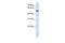 Ectonucleoside Triphosphate Diphosphohydrolase 8 antibody, GTX46626, GeneTex, Western Blot image 