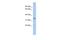 Zinc Finger DHHC-Type Containing 24 antibody, A17159, Boster Biological Technology, Western Blot image 