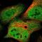 Valosin Containing Protein antibody, NBP1-81620, Novus Biologicals, Immunofluorescence image 