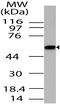 MAPK Associated Protein 1 antibody, A04068, Boster Biological Technology, Western Blot image 