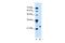Motile Sperm Domain Containing 3 antibody, PA5-42665, Invitrogen Antibodies, Western Blot image 