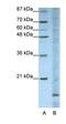 Apolipoprotein O antibody, orb324923, Biorbyt, Western Blot image 