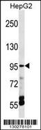 Transient receptor potential cation channel subfamily V member 5 antibody, 58-706, ProSci, Western Blot image 