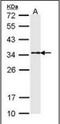 Tropomyosin 1 antibody, orb89955, Biorbyt, Western Blot image 