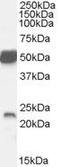 Neurturin antibody, PA5-18769, Invitrogen Antibodies, Western Blot image 