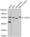 Suppressor Of Cytokine Signaling 4 antibody, GTX33513, GeneTex, Western Blot image 
