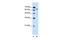 Solute Carrier Family 22 Member 3 antibody, GTX46797, GeneTex, Western Blot image 