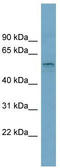Solute Carrier Family 22 Member 15 antibody, TA333751, Origene, Western Blot image 