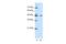 Zinc finger protein 645 antibody, A14415, Boster Biological Technology, Western Blot image 