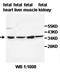 Interleukin 10 Receptor Subunit Beta antibody, orb77824, Biorbyt, Western Blot image 