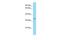 Trophinin antibody, PA5-45460, Invitrogen Antibodies, Western Blot image 