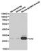 Carbonic Anhydrase 3 antibody, TA327000, Origene, Western Blot image 