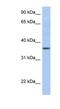 LFNG O-Fucosylpeptide 3-Beta-N-Acetylglucosaminyltransferase antibody, NBP1-59432, Novus Biologicals, Western Blot image 