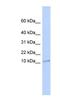 ER Membrane Protein Complex Subunit 6 antibody, NBP1-59735, Novus Biologicals, Western Blot image 