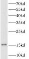 Thyroid Stimulating Hormone Subunit Beta antibody, FNab09807, FineTest, Western Blot image 