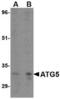 Autophagy Related 5 antibody, TA306517, Origene, Western Blot image 