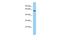 Lactase Like antibody, A14882, Boster Biological Technology, Western Blot image 