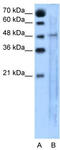 Solute carrier family 25 member 46 antibody, TA333535, Origene, Western Blot image 