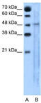 Solute carrier family 25 member 46 antibody, TA333535, Origene, Western Blot image 