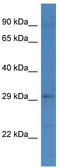 Golgi to ER traffic protein 4 homolog antibody, TA343126, Origene, Western Blot image 