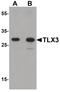 T Cell Leukemia Homeobox 3 antibody, PA5-34555, Invitrogen Antibodies, Western Blot image 