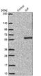 Cobalamin Binding Intrinsic Factor antibody, NBP1-81611, Novus Biologicals, Western Blot image 