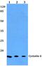 Cystatin A antibody, PA5-75206, Invitrogen Antibodies, Western Blot image 