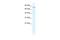 DEAD-Box Helicase 23 antibody, A09077-1, Boster Biological Technology, Western Blot image 