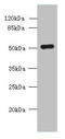 Solute Carrier Family 38 Member 2 antibody, orb356795, Biorbyt, Western Blot image 