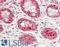 HSP73 antibody, LS-B14258, Lifespan Biosciences, Immunohistochemistry paraffin image 