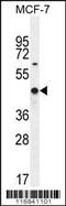 WT1 Transcription Factor antibody, MBS9203569, MyBioSource, Western Blot image 