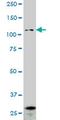 Protocadherin Gamma Subfamily A, 2 antibody, MA5-22250, Invitrogen Antibodies, Western Blot image 