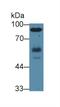 HCK Proto-Oncogene, Src Family Tyrosine Kinase antibody, MBS2027347, MyBioSource, Western Blot image 