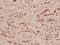 p53 antibody, A00001S9-1, Boster Biological Technology, Immunohistochemistry frozen image 