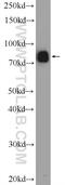 DDHD Domain Containing 2 antibody, 25203-1-AP, Proteintech Group, Western Blot image 
