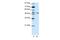 Potassium Voltage-Gated Channel Subfamily A Regulatory Beta Subunit 2 antibody, NBP1-80271, Novus Biologicals, Western Blot image 