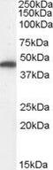 Fumarate Hydratase antibody, GTX89022, GeneTex, Western Blot image 