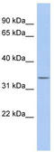 Outer Dense Fiber Of Sperm Tails 4 antibody, TA337858, Origene, Western Blot image 