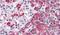 Transmembrane Serine Protease 4 antibody, PA5-34271, Invitrogen Antibodies, Immunohistochemistry paraffin image 