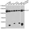 Valosin Containing Protein antibody, A13368, ABclonal Technology, Western Blot image 