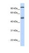 DEAH-Box Helicase 32 (Putative) antibody, NBP1-57347, Novus Biologicals, Western Blot image 