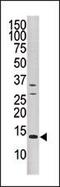 Dual Specificity Phosphatase 15 antibody, PA5-15567, Invitrogen Antibodies, Western Blot image 