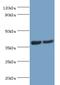 ATPase H+ Transporting Accessory Protein 2 antibody, LS-C375290, Lifespan Biosciences, Western Blot image 