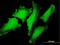 VHL Binding Protein 1 antibody, H00007411-B01P, Novus Biologicals, Immunocytochemistry image 