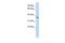 Keratin 222 antibody, GTX45669, GeneTex, Western Blot image 