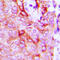 Adhesion G Protein-Coupled Receptor L2 antibody, GTX55247, GeneTex, Immunohistochemistry paraffin image 