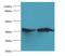 Carbonic Anhydrase 5B antibody, LS-C372355, Lifespan Biosciences, Western Blot image 