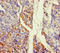 Aldehyde dehydrogenase family 1 member L2 antibody, LS-C395585, Lifespan Biosciences, Immunohistochemistry paraffin image 